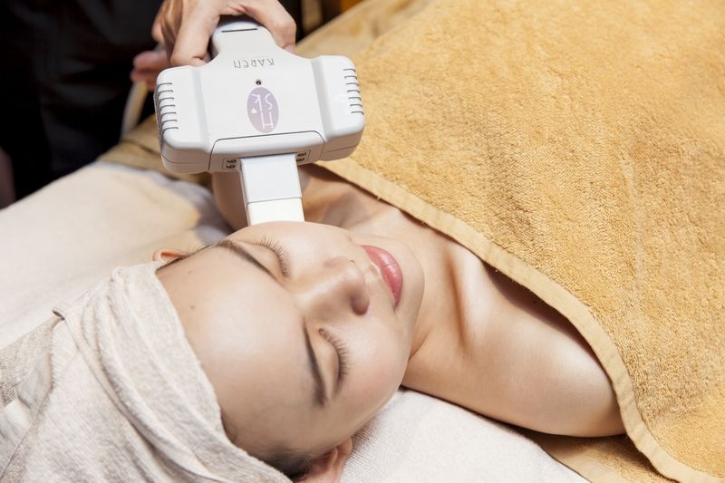 Phương pháp HSE tiên tiến không gây tổn thương cho da